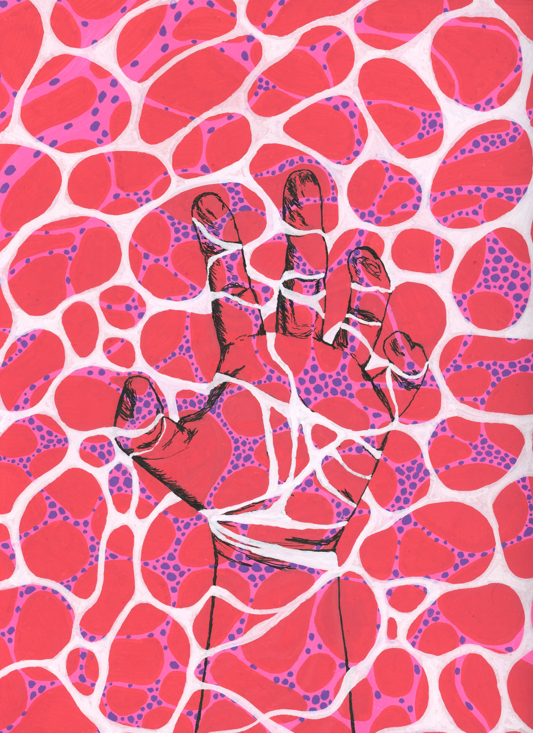 Staying Afloat with a Rare Disease by Waiyee Hui